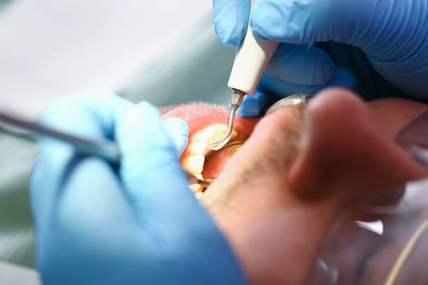 Best Emergency Treatment for Toothache in Totowa, NJ