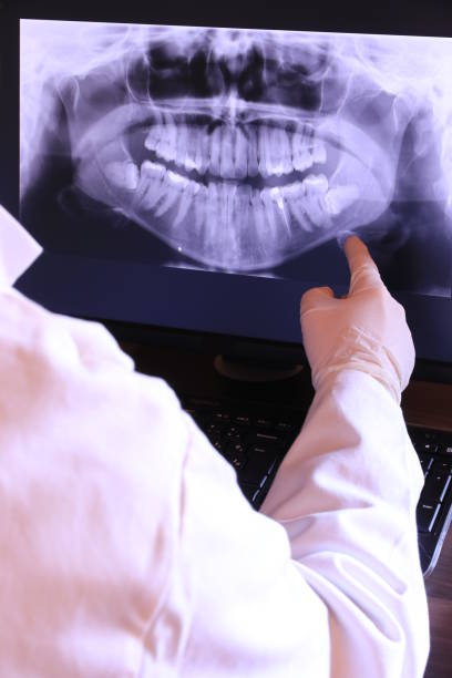 Best Emergency Wisdom Teeth Removal in Totowa, NJ