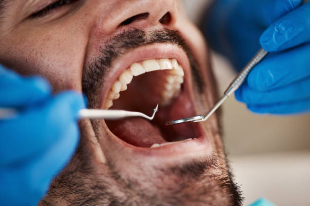 Best Emergency Broken Tooth Repair in Totowa, NJ